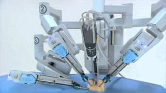 機(jī)器人制霸手術(shù)臺 外企壟斷格局下，國產(chǎn)普通機(jī)械制造的突圍之路